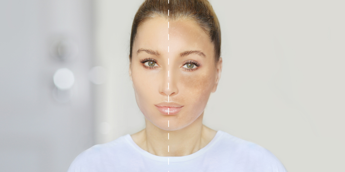 Pregnancy Skin Issues & Pregnancy Safe Skincare 